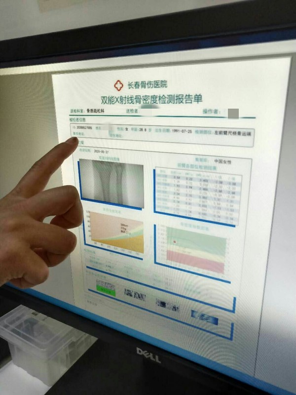 品源雙能X射線骨密度儀落戶吉林省長(zhǎng)春骨傷醫(yī)院，助力骨松診療